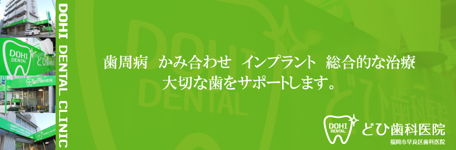 dohi dental clinic どひ歯科医院 歯周病 かみ合わせ インプラント 総合的な治療 福岡市早良区歯科医院