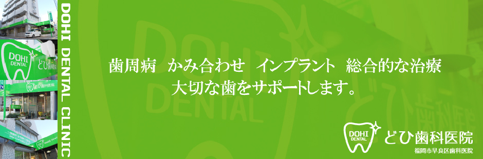 歯周病 かみ合わせ インプラント 総合的な治療 大切な歯をサポートします。どひ歯科医院